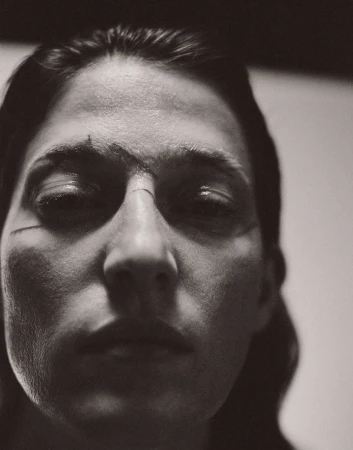 Close-up black and white portrait of a person with markings on their face looking directly at the camera with soft, diffused lighting.