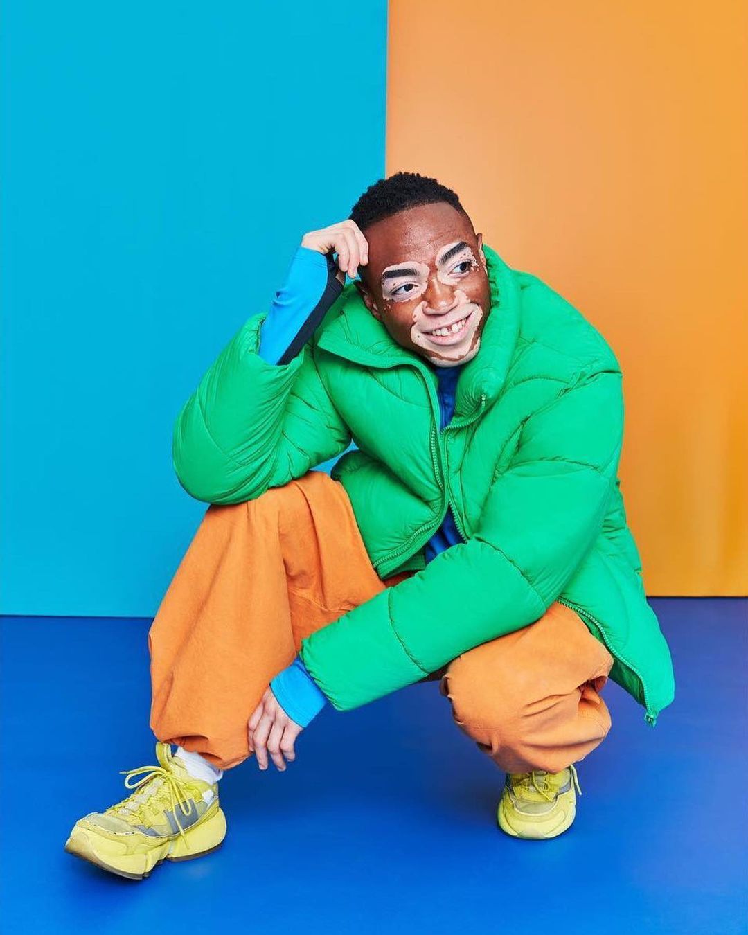 Portrait of a man with vitiligo wearing a green puffer jacket and orange pants, crouching against a backdrop of blue and orange.