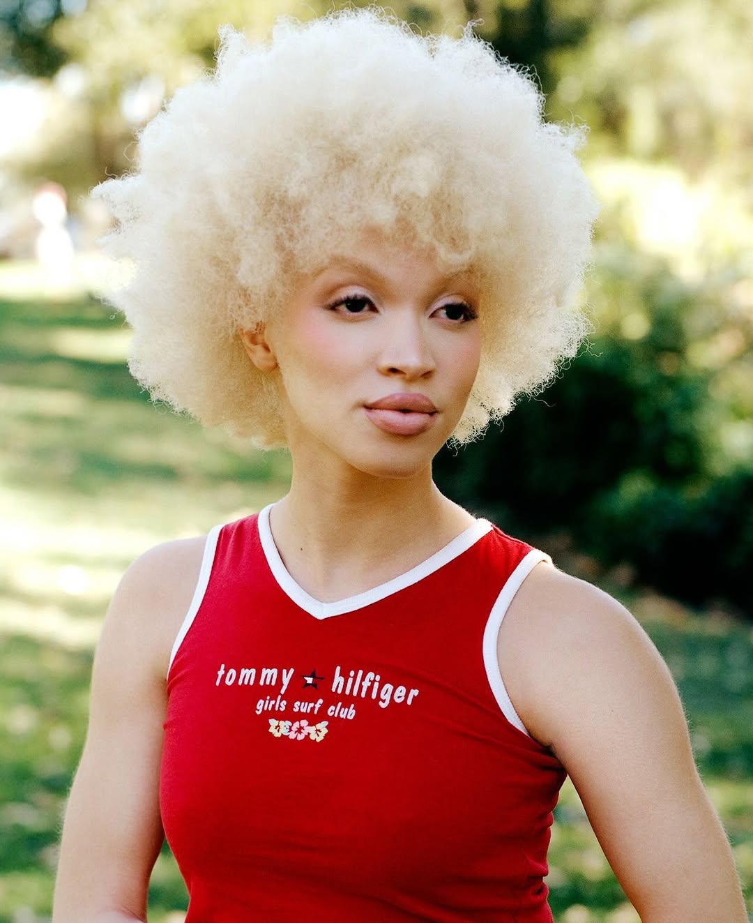 Albino woman with afro poses outdoors wearing Tommy Hilfiger tank top in a close-up shot on a sunny day in a green setting.