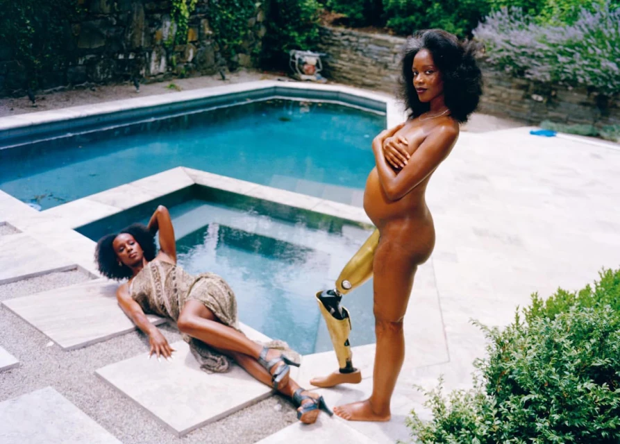 A black, pregnant woman with a prosthetic leg stands outdoors near a pool, while another black woman lies on tile near the pool.