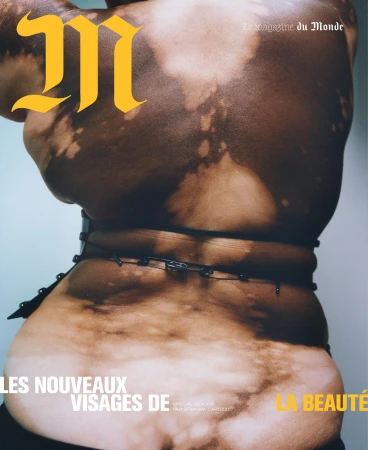 Magazine cover featuring the back of a woman with vitiligo, wearing a studded belt against a neutral background, and magazine text overlay.