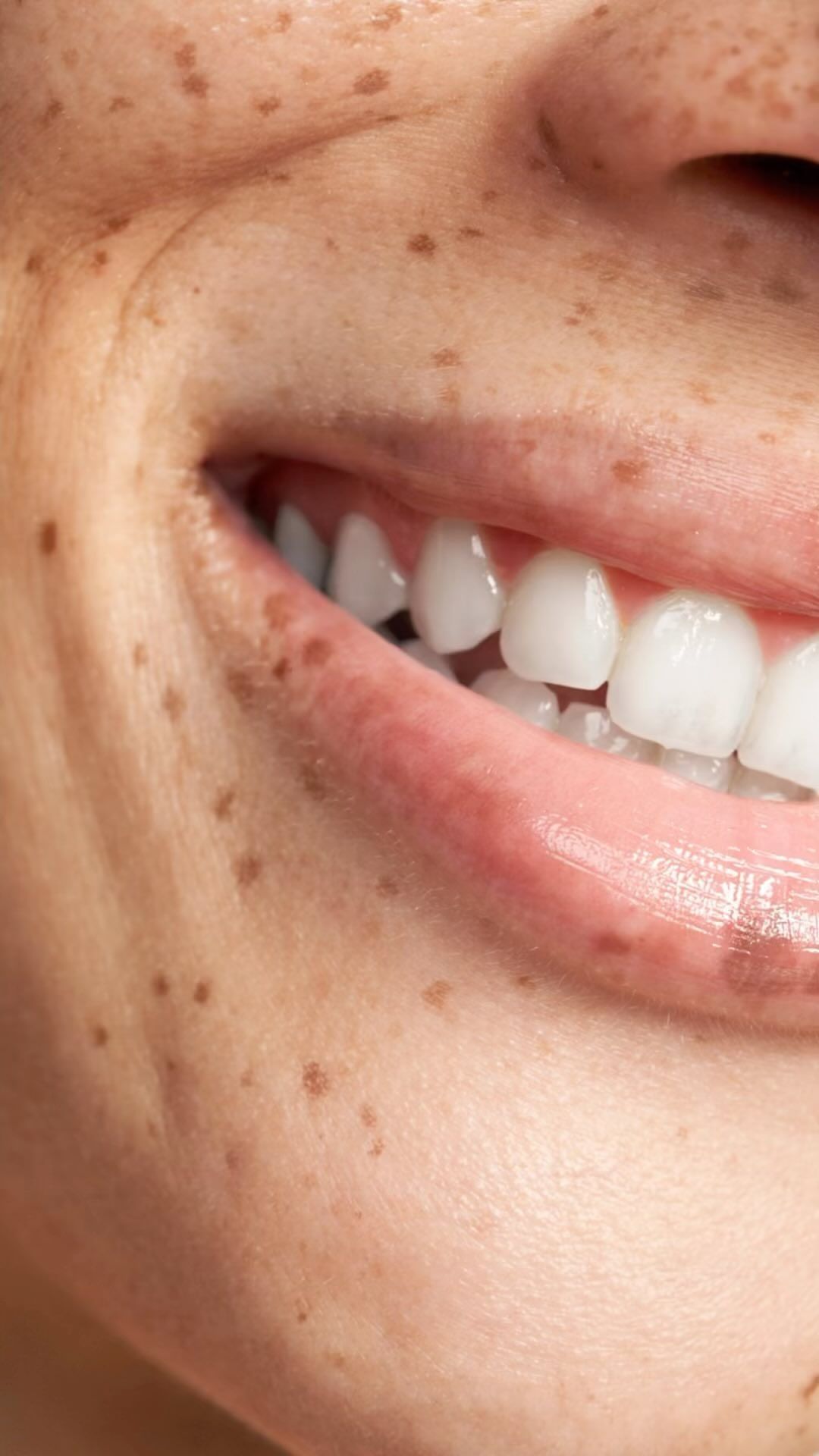 Extreme close-up of a smiling mouth showing white teeth and freckled skin, photographed by Candy Kennedy.