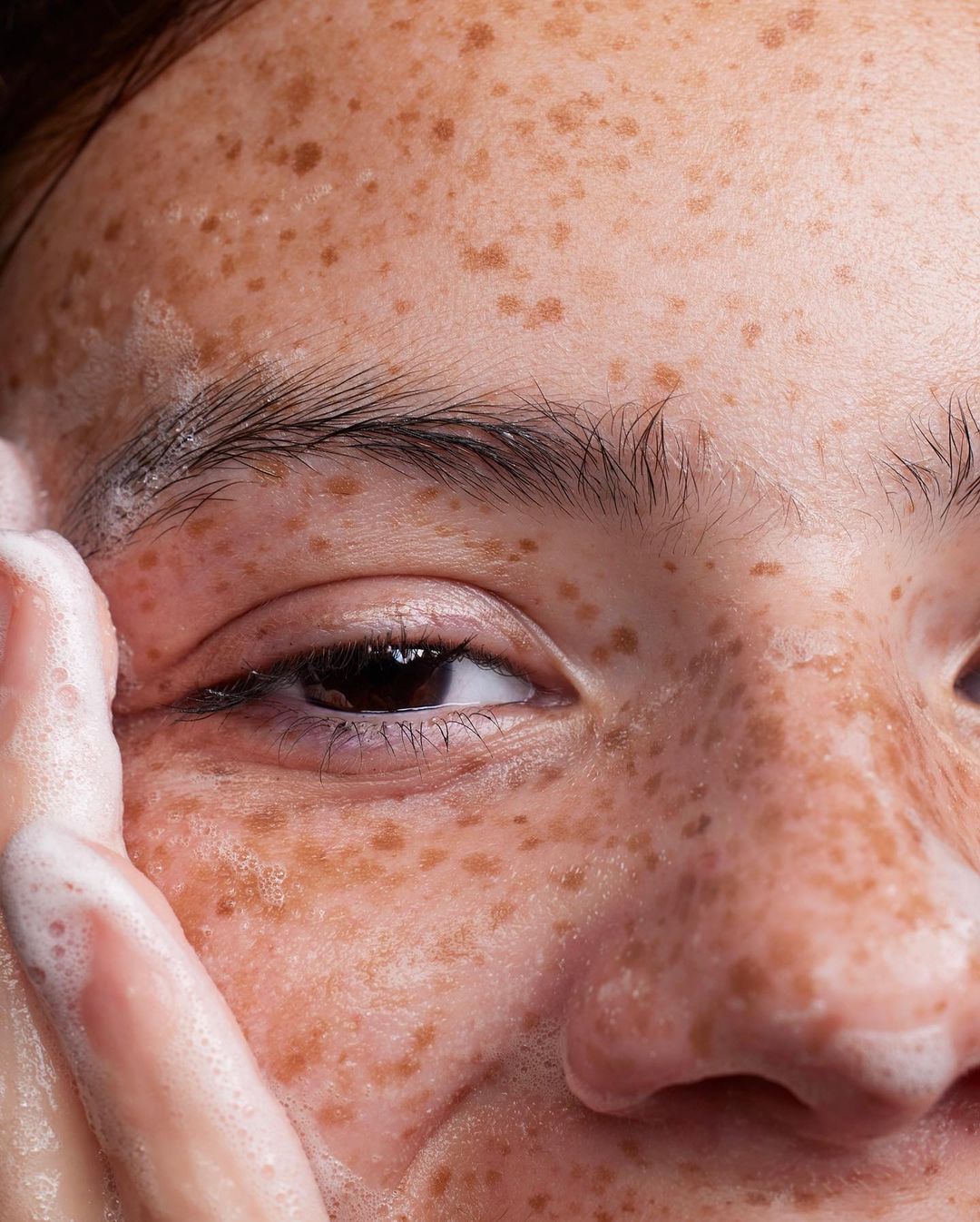 Close-up of a person's face with freckles and soap suds, focusing on skin texture and skincare details in a beauty context.
