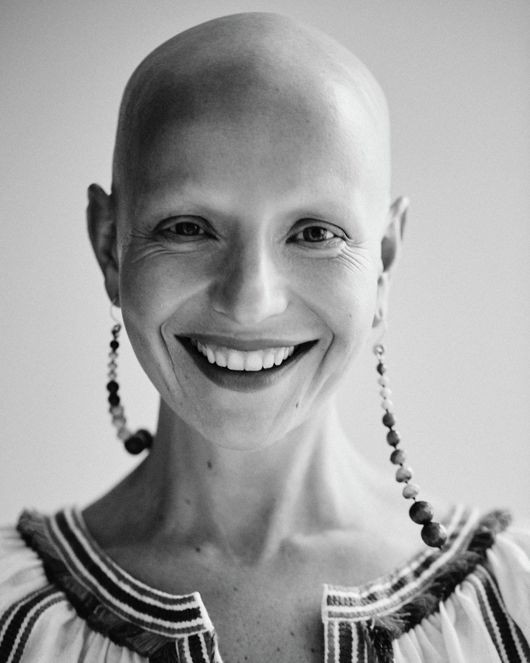 Close-up portrait of a smiling, bald adult woman with long, beaded earrings, wearing a striped blouse, against a neutral background.