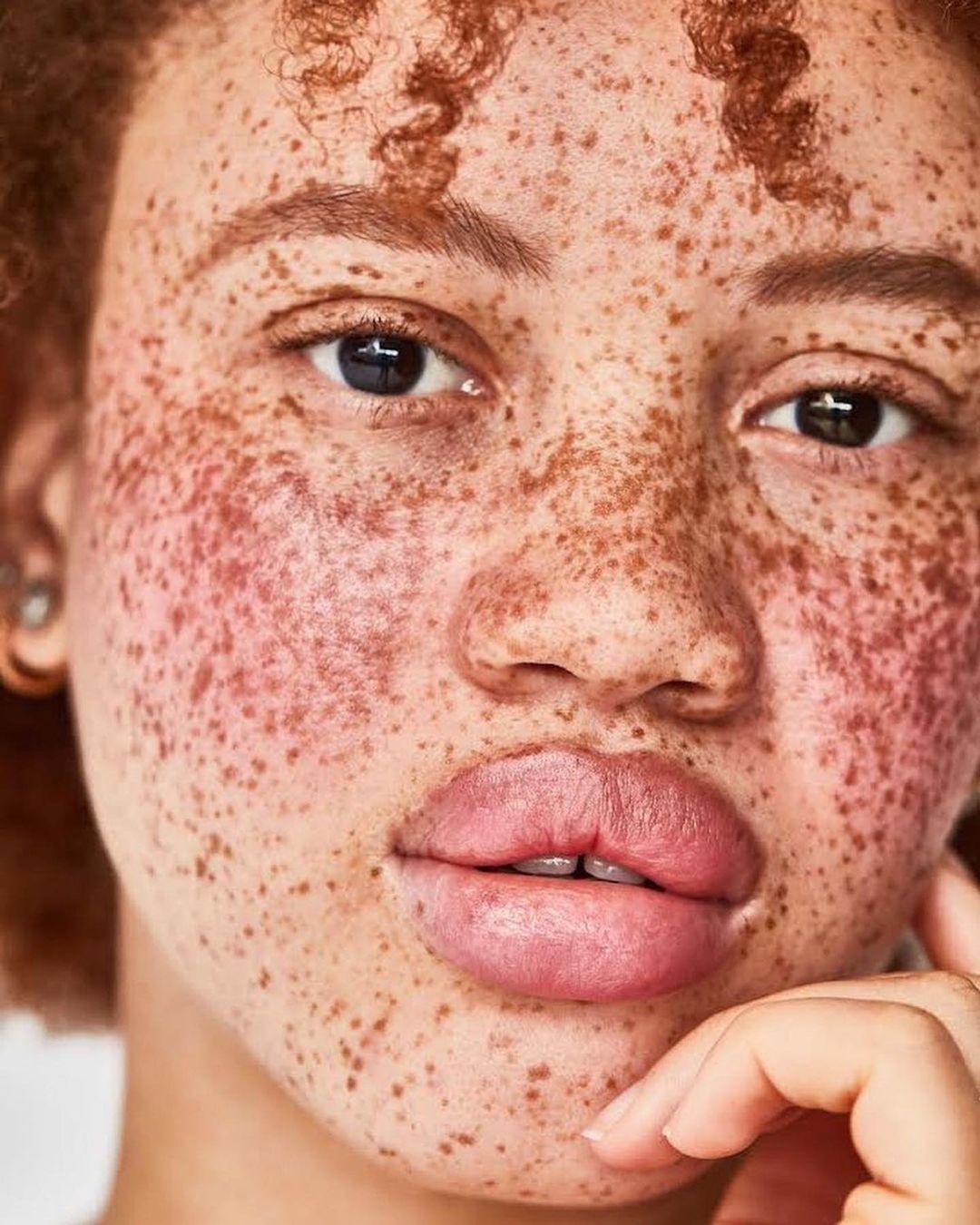 Close-up portrait of a woman with heavy freckles across her face, captured by photographer Chaunté Vaughn.