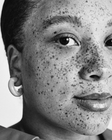 Close-up monochrome portrait of a Black woman with prominent freckles wearing a hoop earring, photographed by Christin Rose.