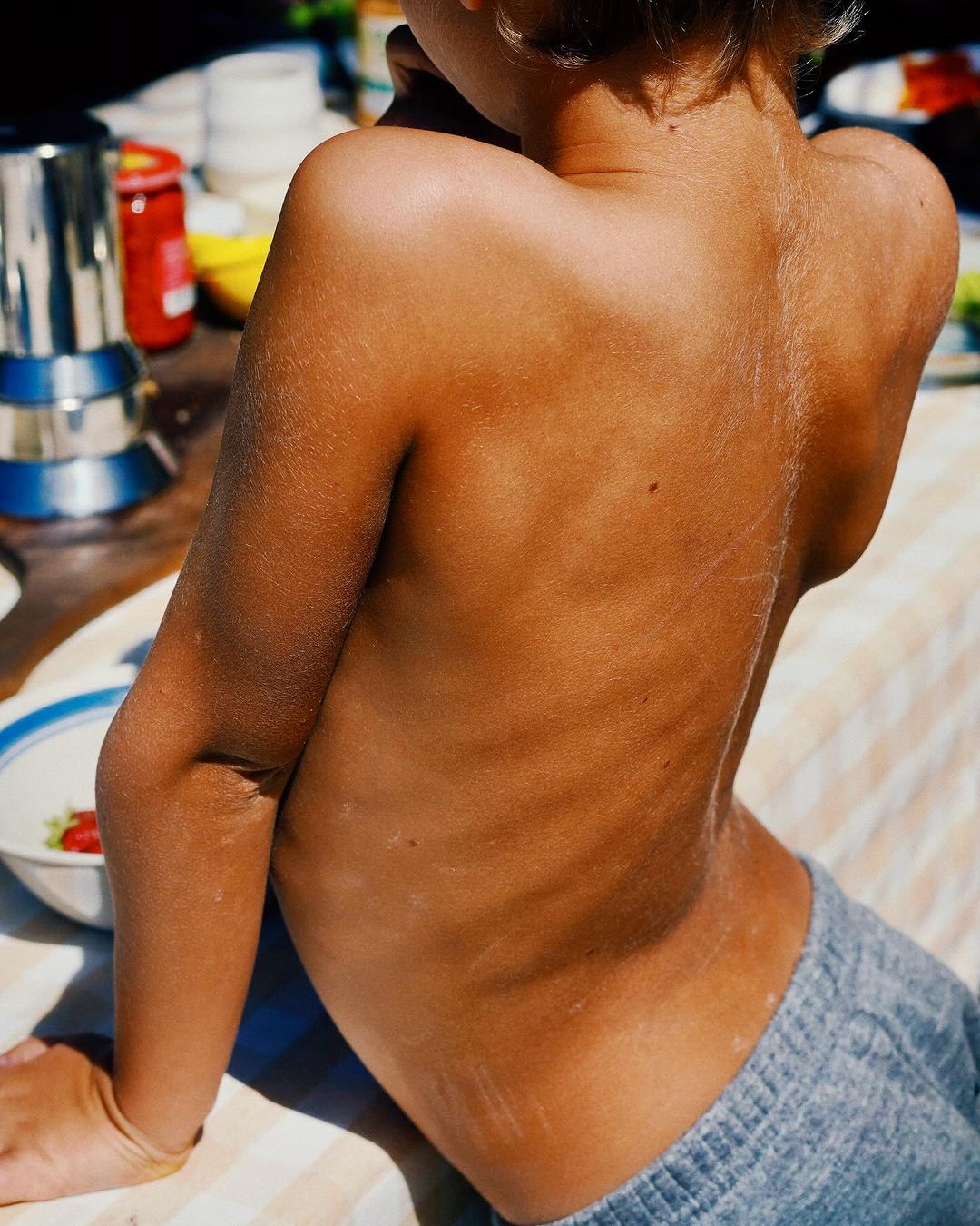 Child sitting with exposed back and shoulders, showing skin tone variations and detail; outdoor setting with table and kitchenware.