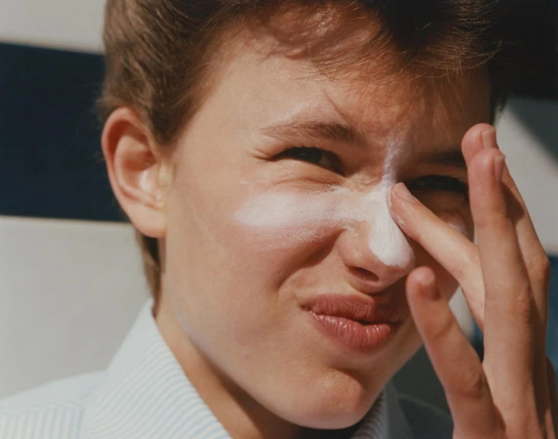 Close-up of a fair-skinned young adult applying sunscreen to their face with their fingers, wearing a striped shirt, with sunlight.