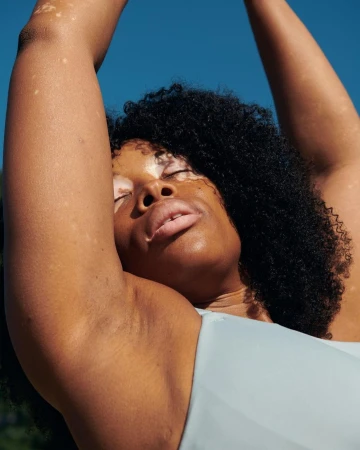 Close-up of Black woman with vitiligo raising her arms, showcasing her underarm skin and body positivity, set against a bright blue sky backdrop.