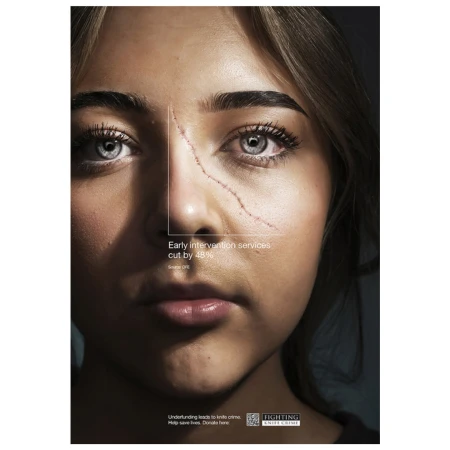 Close-up promotional image of an adult female's face, with scar, featuring campaign messaging and logo for 'Fighting Knife Crime'.