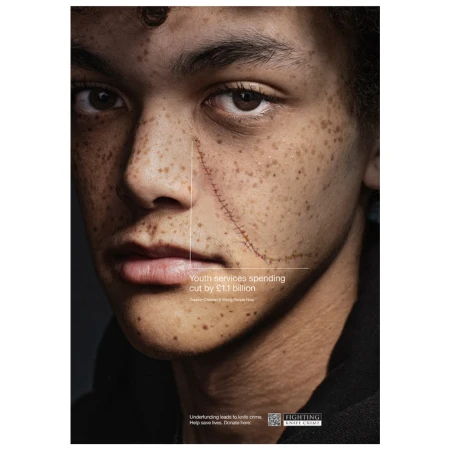 Close-up of a young person's face with visible scars, part of a social awareness campaign against youth violence. The image is dramatically lit.