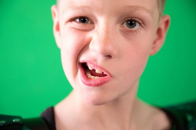 Close-up portrait of a young Caucasian boy with light hair and missing front teeth, smiling with a distorted expression against a green backdrop.