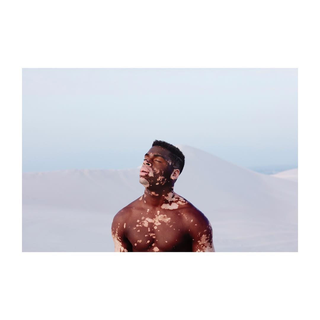 A shirtless adult male with vitiligo standing on a sandy dune with his head tilted back, eyes closed, illuminated by natural light.