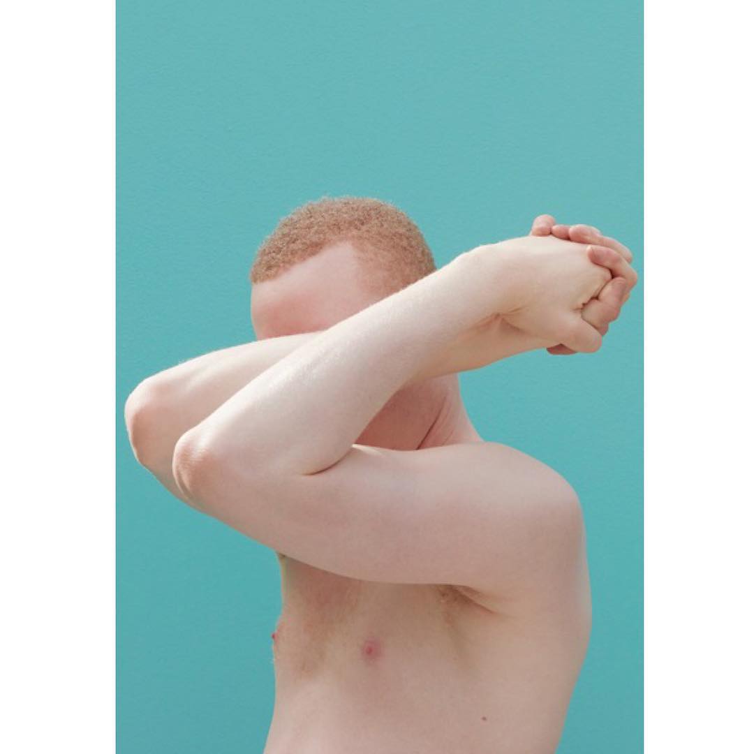 Studio portrait of a shirtless albino man with red hair covering his face with his arms against an aqua blue seamless background.