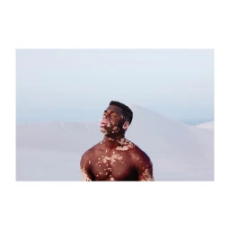 Shirtless black man with vitiligo standing outdoors against a pale sand dune landscape in Cape Town, photographed by Dirk Rees.