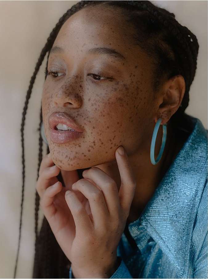 Close-up of a young African-descent woman with freckles and braided hair, wearing blue hoop earrings and a light-blue shimmering shirt.