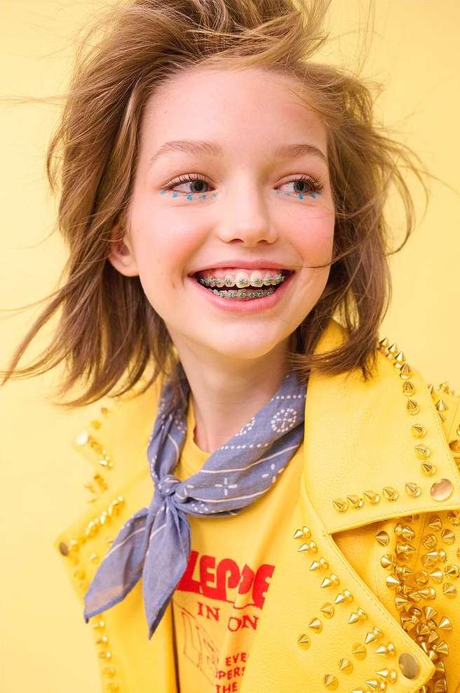 Smiling girl with braces and glitter makeup wears a yellow studded jacket with a bandana against a yellow background in a medium shot.