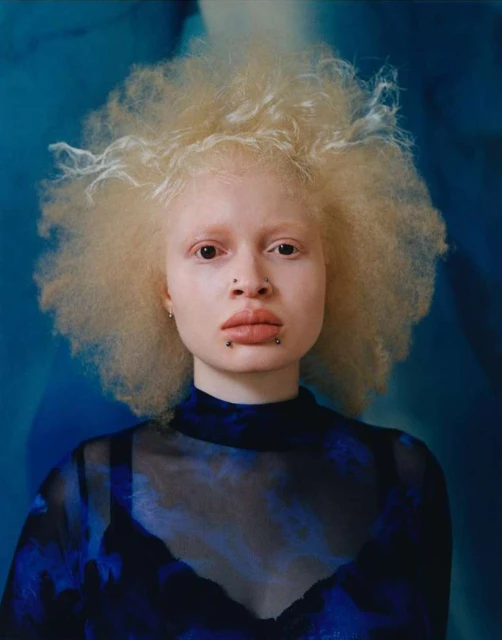 Close-up portrait of an albino woman with blonde afro hair, face piercings, and a blue patterned top against a matching backdrop.