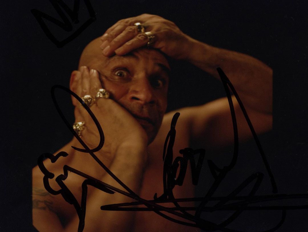 Bald man with hands on face, wearing rings, with wide-eyed expression against dark background. Portrait orientation.
