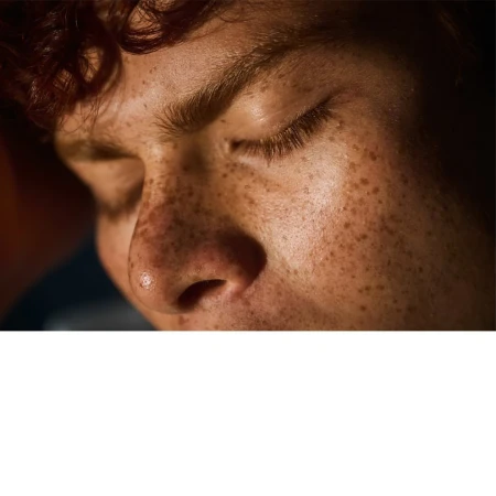 Close-up portrait of a young person with red curly hair and prominent freckles across the face and nose, eyes closed.