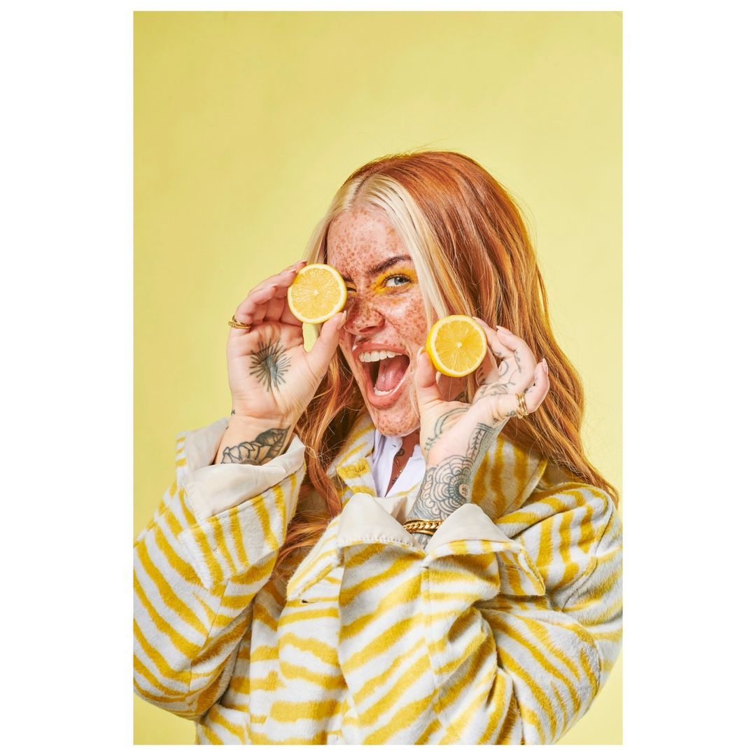 A woman with red hair and freckles smiles and holds lemon halves to her eyes against a yellow background, wearing a striped jacket.