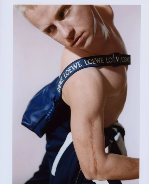 Albino male model in a fashion studio wearing a blue Loewe belt bag, showcasing an editorial style with soft lighting and a minimalist aesthetic.