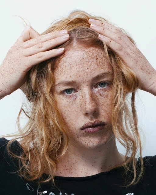 Close-up portrait of a young woman with red hair and freckles, holding her hands on her head in front of a white background.