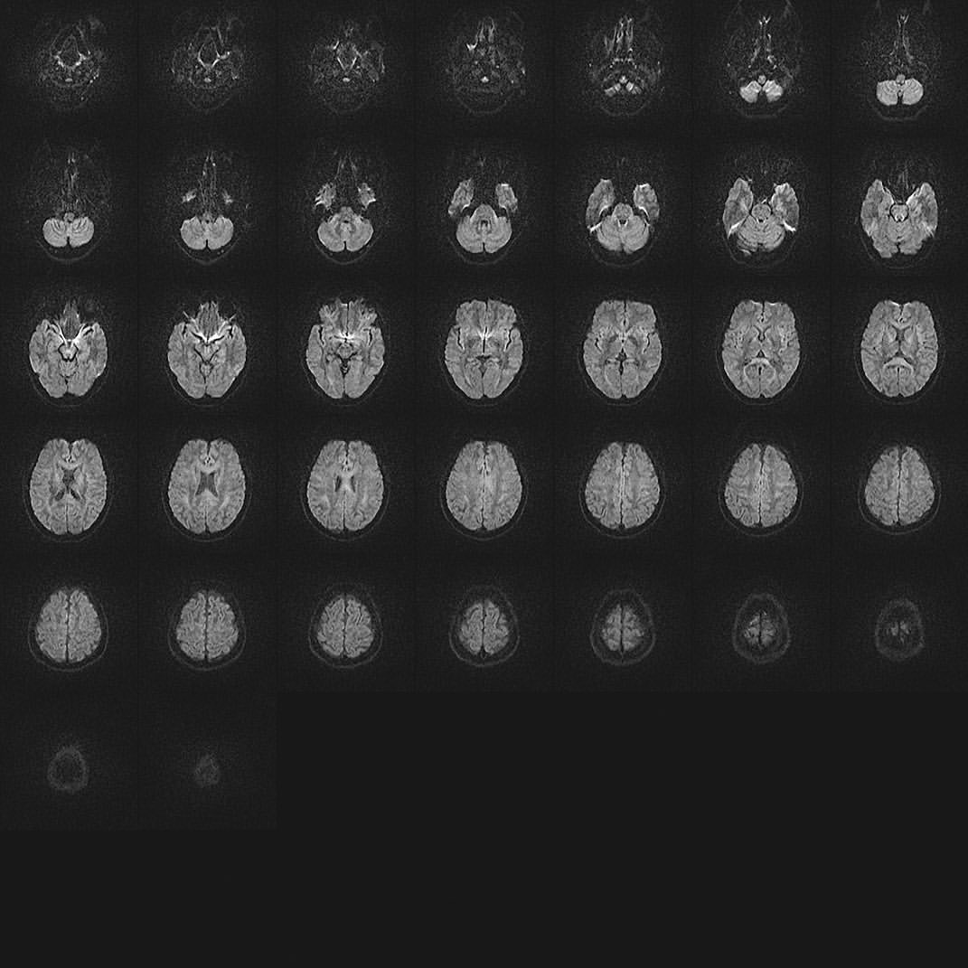 Multiple brain scans displayed in a grid-like pattern, used in healthcare for diagnostic imaging, and medical research in a dark environment.