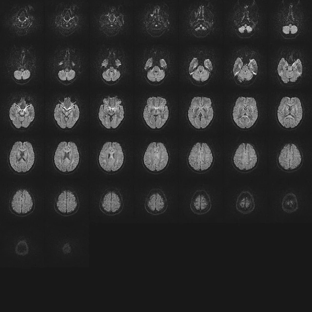 Multiple brain scans displayed in a grid-like pattern, used in healthcare for diagnostic imaging, and medical research in a dark environment.