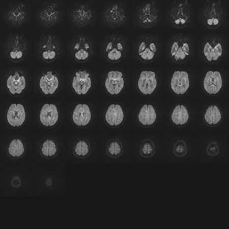 Multiple brain scans displayed in a grid-like pattern, used in healthcare for diagnostic imaging, and medical research in a dark environment.