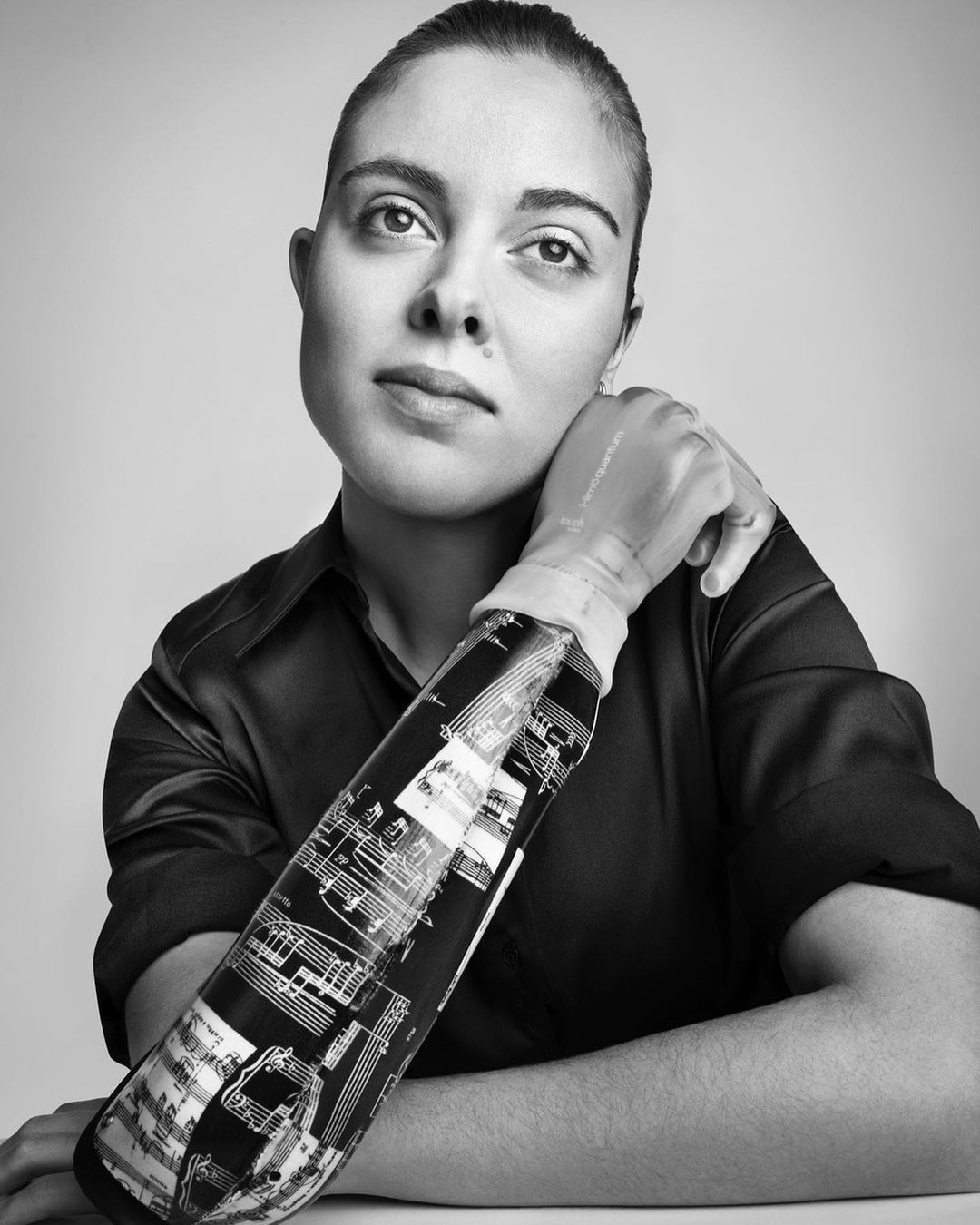 Black-and-white portrait of a woman with a prosthetic arm featuring a musical score design, gazing upward with a thoughtful expression.