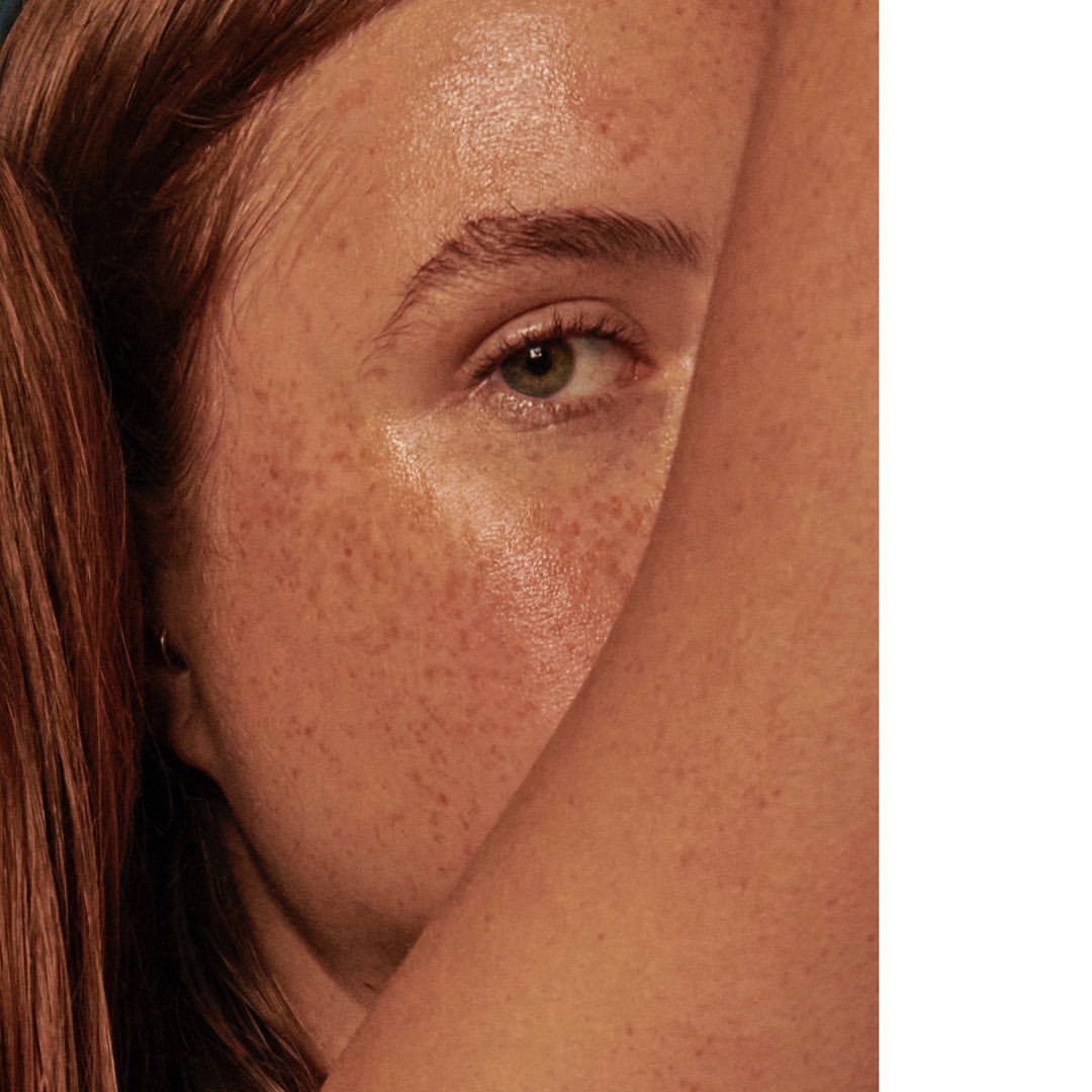 Close-up portrait of a fair-skinned woman with freckles, red hair, and green eyes partially obscured by her arm in warm lighting.