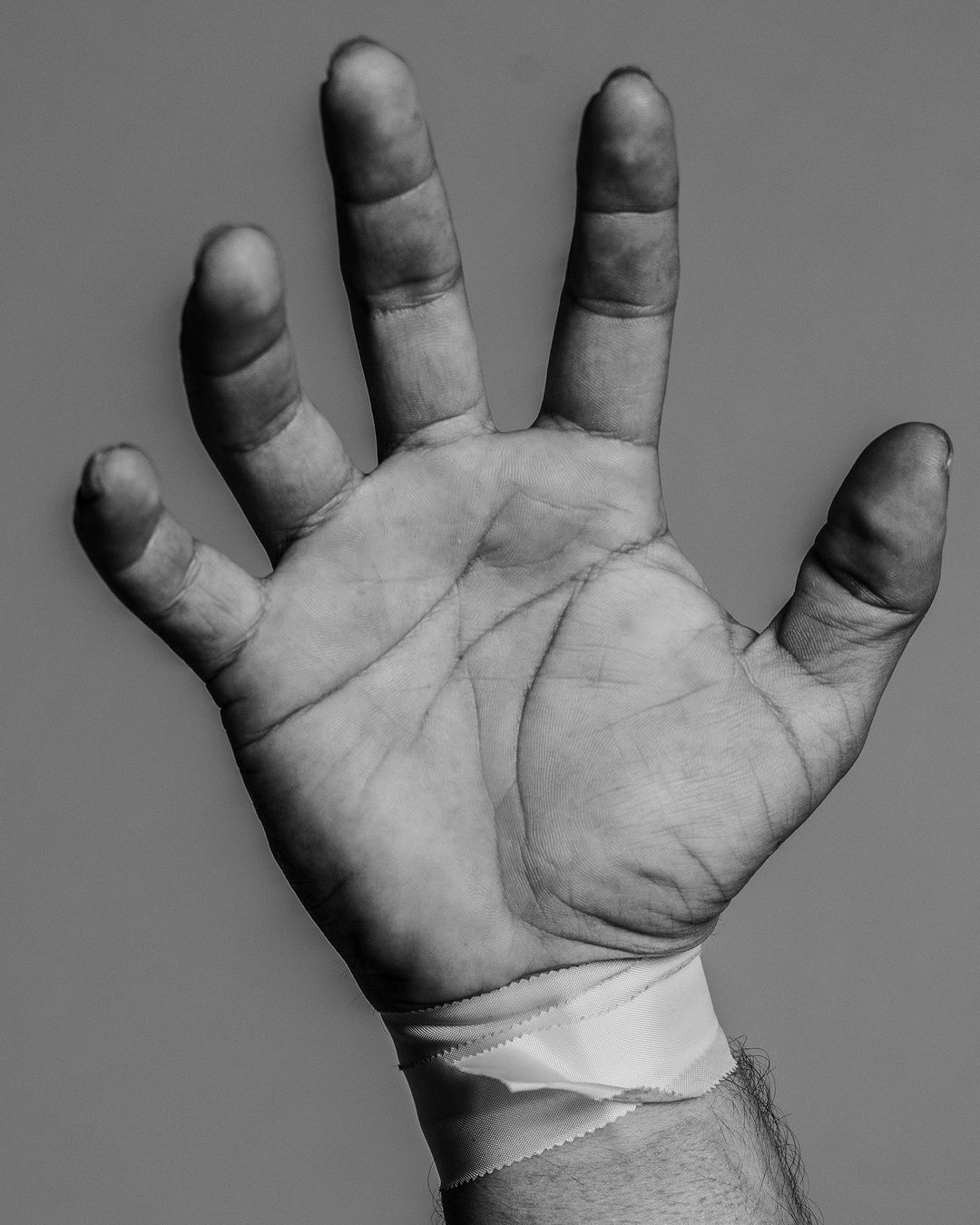 Close-up shot of an adult male hand with a wrist bandage, showing the palm, fingers, and tendons in a high contrast black and white image.
