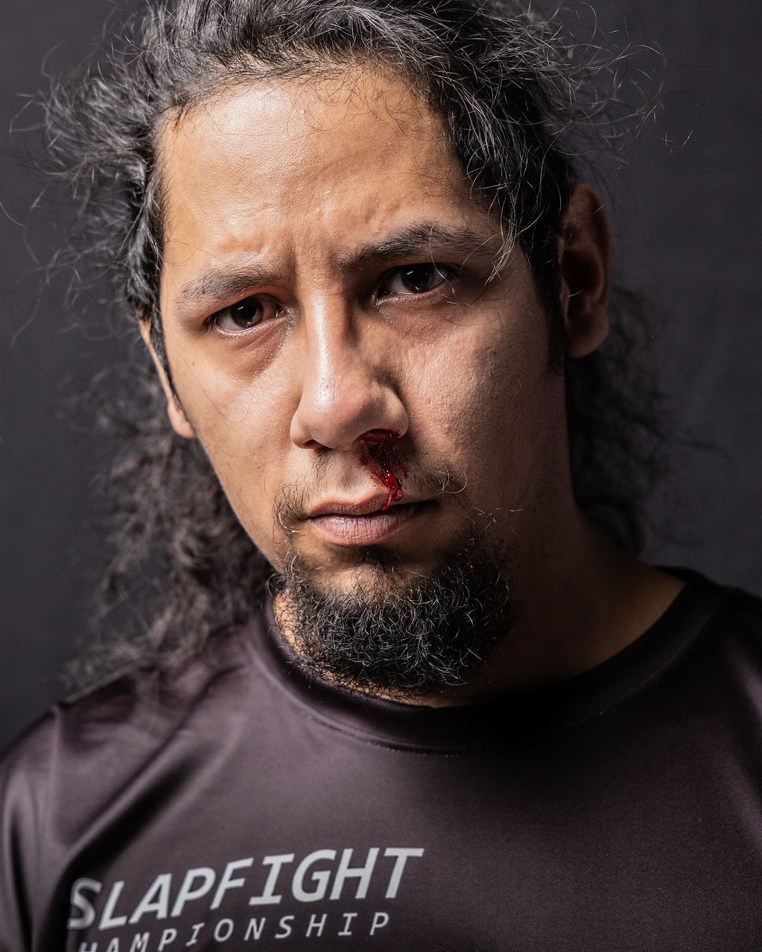 Close-up of a disheveled man with a bloody nose, wearing a black t-shirt with 'SLAPFIGHT CHAMPIONSHIP' text, set against a dark backdrop.