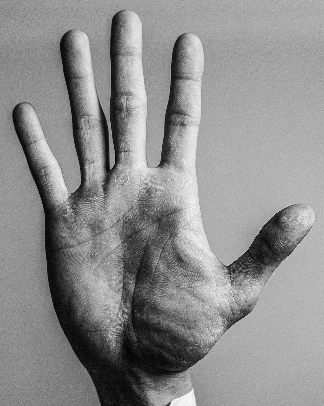 Monochrome image features a close-up of an adult hand, palm open, with visible lines, pores, and texture details on a neutral background.