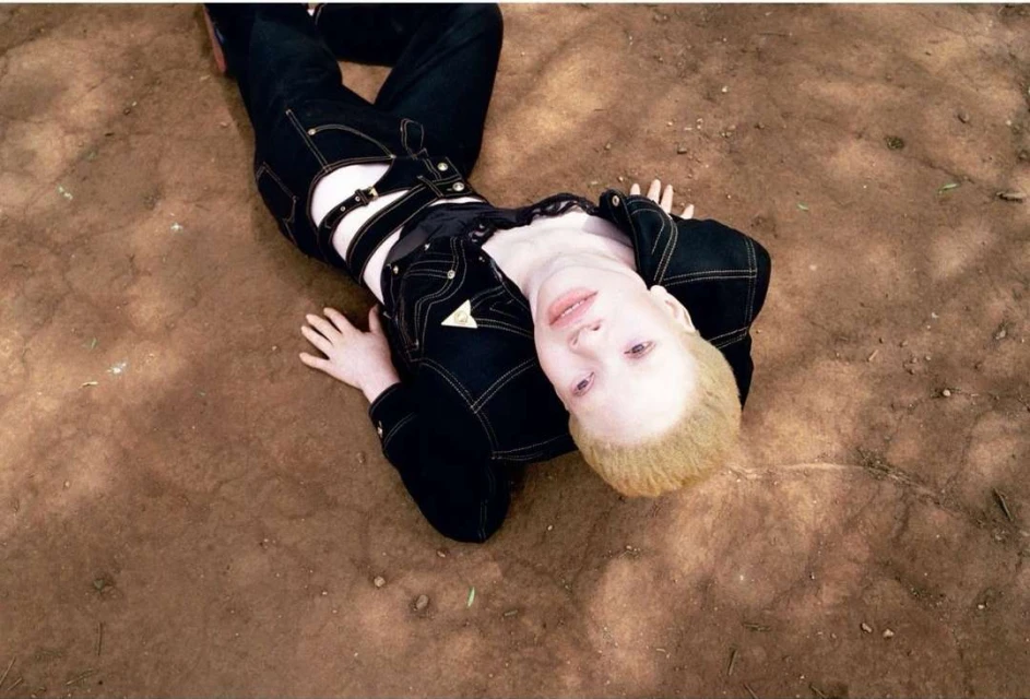 Albino model lies on dirt in a black outfit, looking up into the camera, blonde hair, with an outdoor setting in the background.