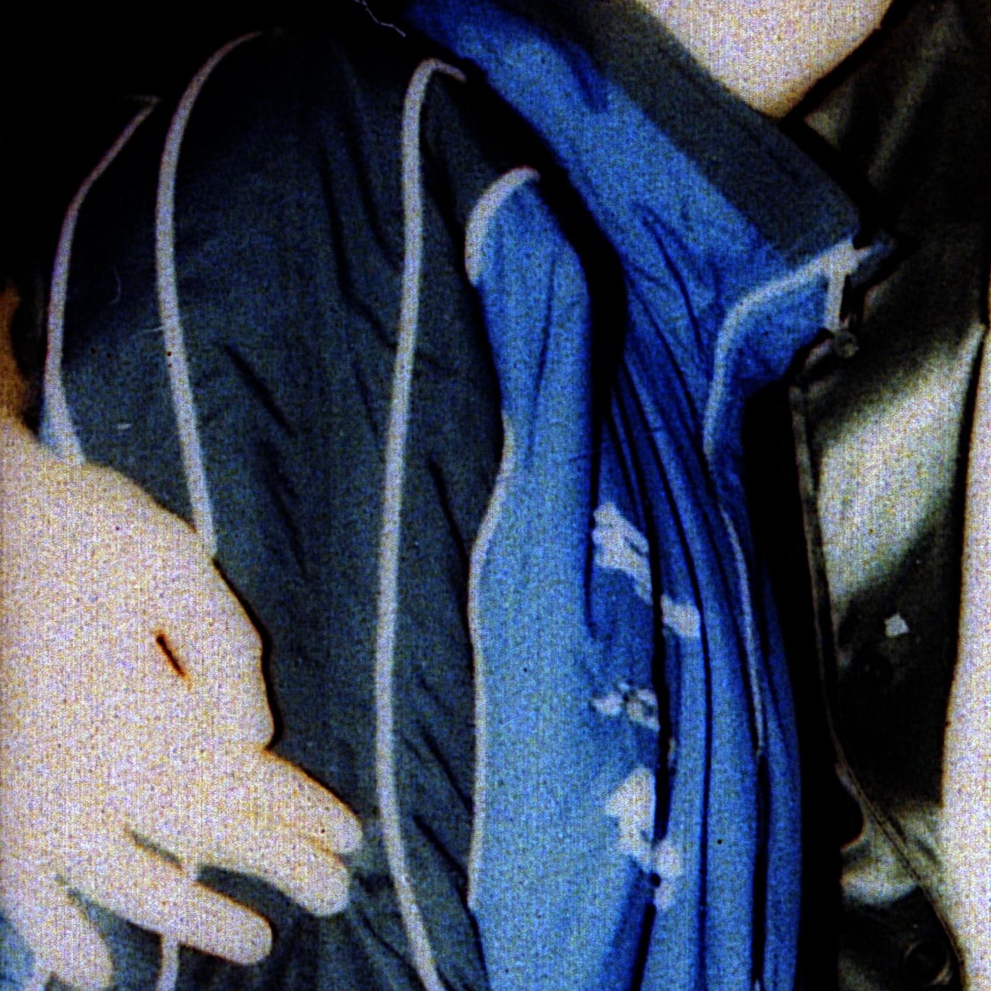 Close-up image of an arm in what appears to be medical attire, featuring a blue and gray patterned gown and white gloves.