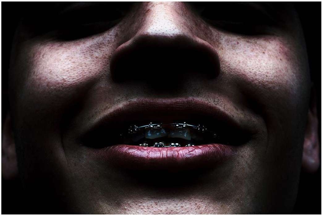 Extreme close-up of adult human face with metal dental braces, under dark and dramatic lighting, revealing skin details and texture.