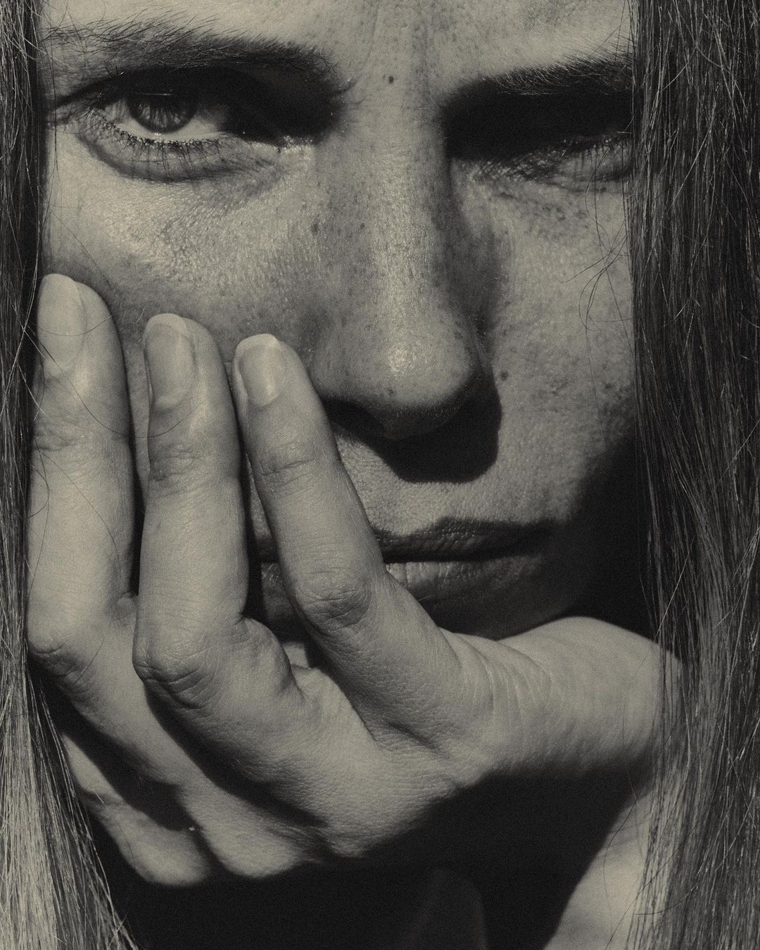 Monochrome portrait of a woman with hand on face, displaying skin texture, freckles, and serious expression, captured in soft, diffused lighting.