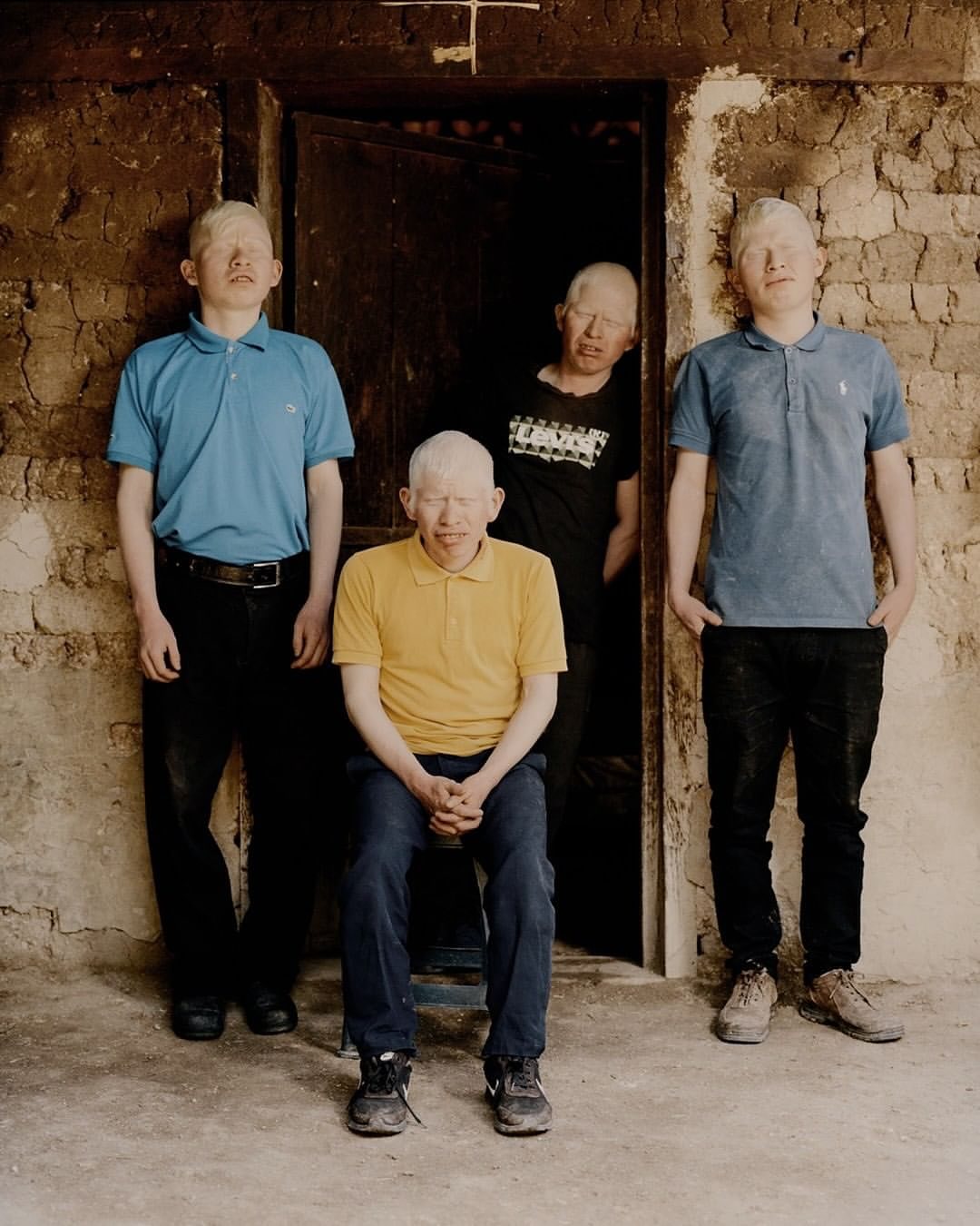 Four albino men pose in front of a doorway in a textured wall, two wearing blue polo shirts, one in yellow, and one in black.