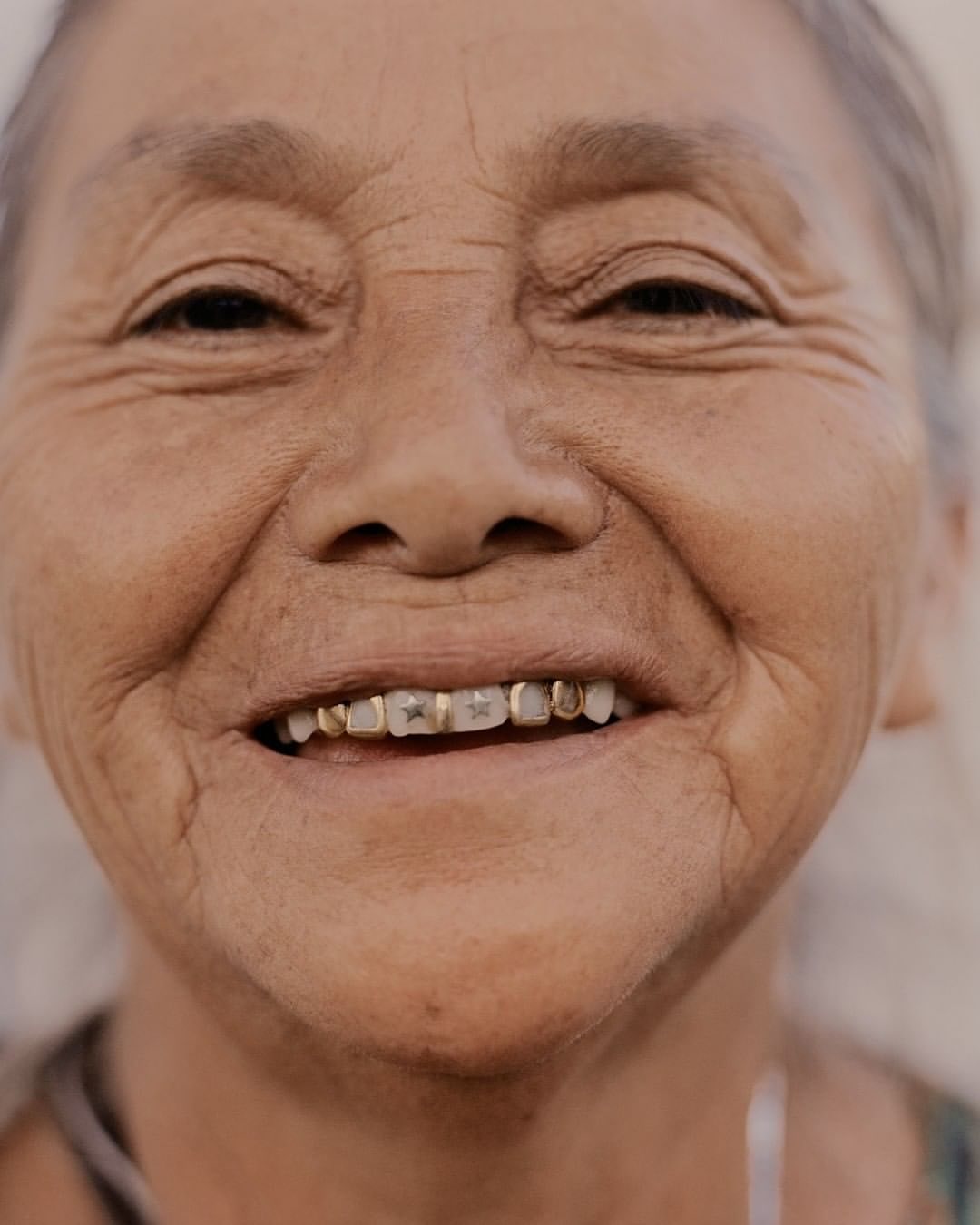 Close-up of an elderly woman smiling with gold dental crowns. Facial wrinkles are visible. Neutral background.