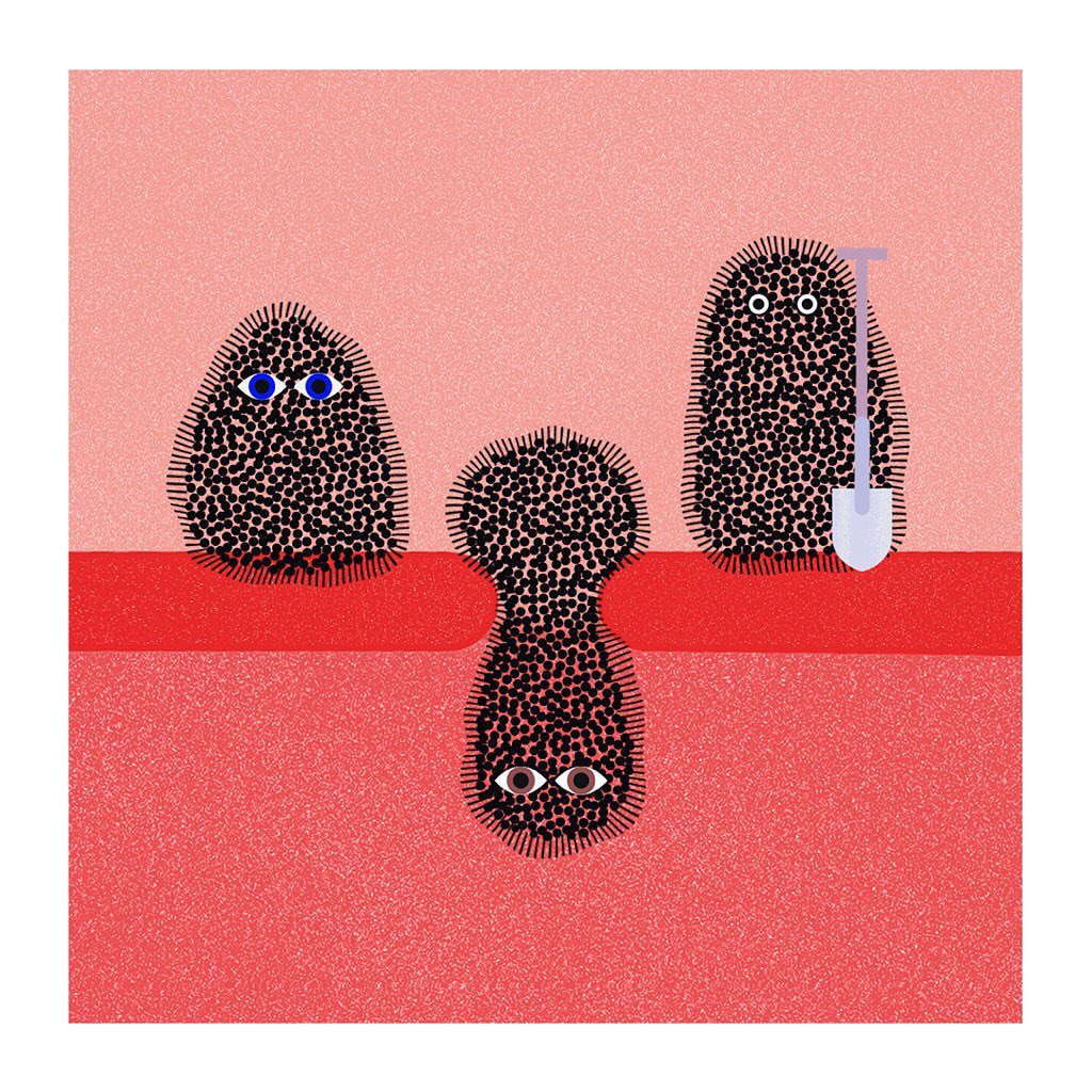 Animated illustration of three skin pores with blackheads; one holds a shovel, set against a light pink background, and a red stripe.