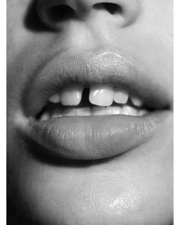 Close-up studio shot in black and white featuring an open mouth with teeth, lips, and part of a person's face visible.