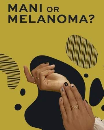Close-up of manicured hands with minimalist nail art, gold rings, set against a mustard yellow and black graphic patterned background.