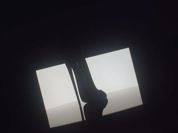 Medical X-ray image showing a leg with visible tibia and fibula bones against a bright white illuminated screen in a dark room.
