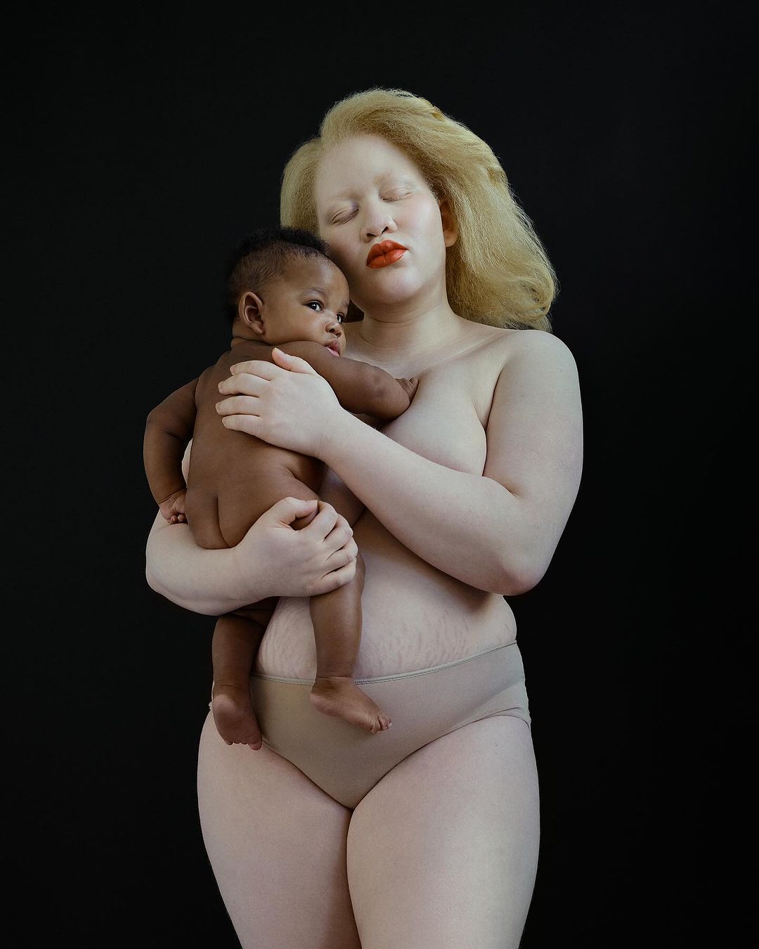 Albino woman gently holds a Black baby against a black background, showcasing a powerful image of love and diversity in motherhood.