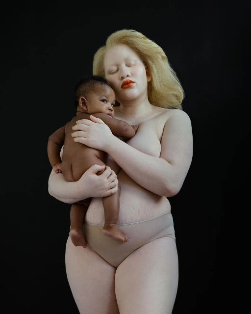 Albino woman gently holds a Black baby against a black background, showcasing a powerful image of love and diversity in motherhood.