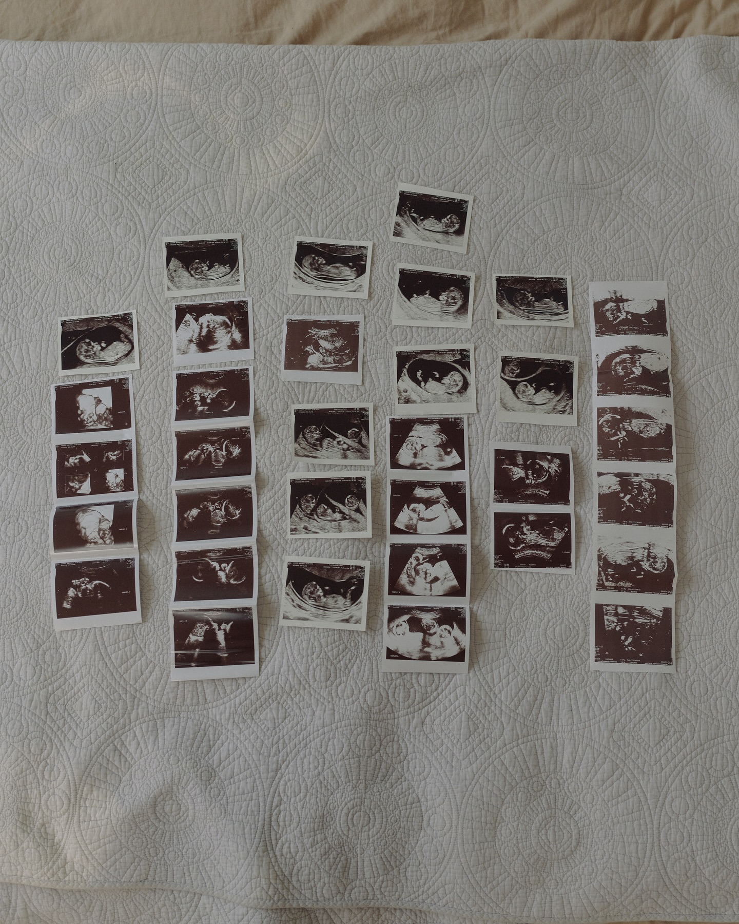 Multiple ultrasound images displayed on a patterned white surface, revealing different stages of prenatal development.