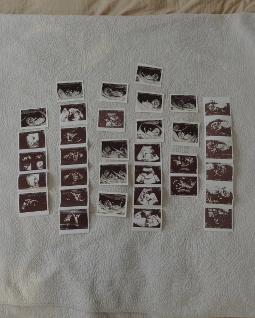 Multiple ultrasound images displayed on a patterned white surface, revealing different stages of prenatal development.