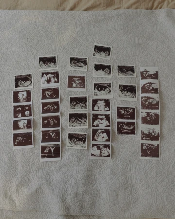 Multiple ultrasound images displayed on a patterned white surface, revealing different stages of prenatal development.